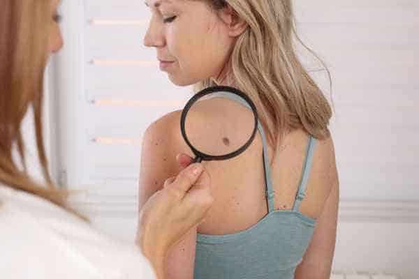 What Are Traditional Skin Lesion Removal Methods Oakham?