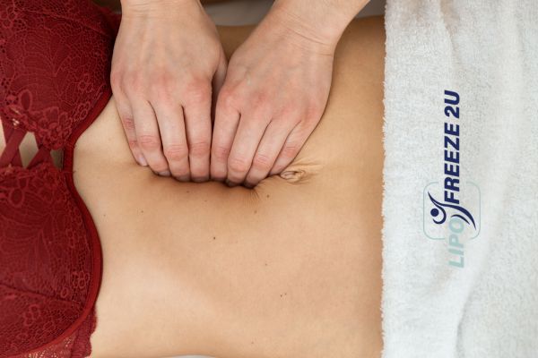 diastasis recti treatment Oakham