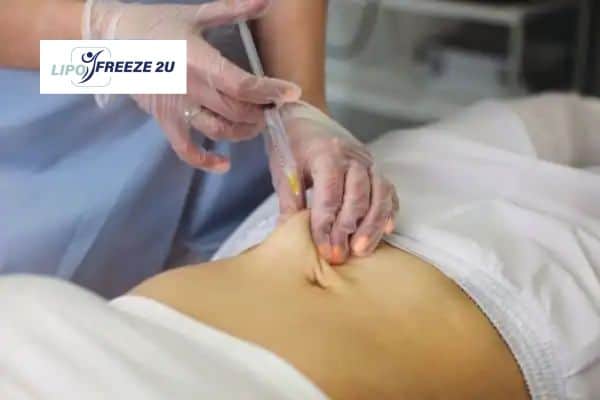 Fat Dissolving Injections Oakham & Weight loss medication