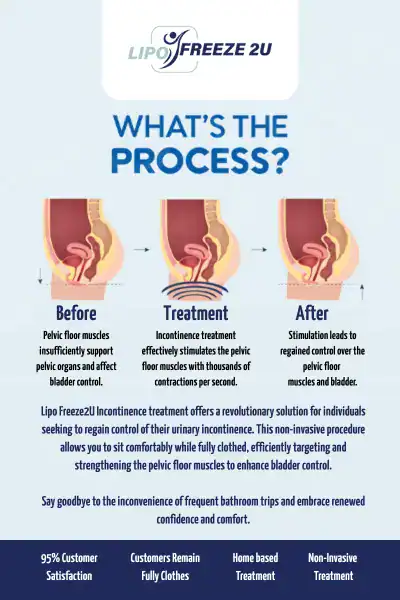 Diagram of how incontinence treatment Oakham works.