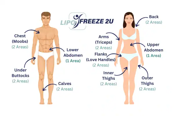 Areas you can have fat freezing treatment Oakham
