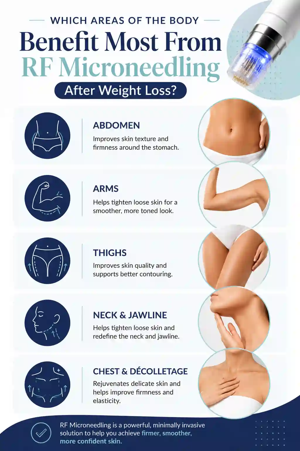 Which Areas of the Body Benefit Most From RF Microneedling After Weight Loss Oakham